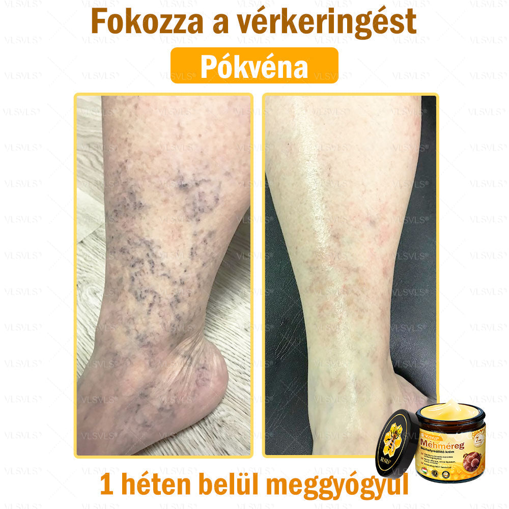 💪💪VLSVLS® Méhméreg Bőrhelyreállító Krém (👨⚕CE jóváhagyott)👍✅