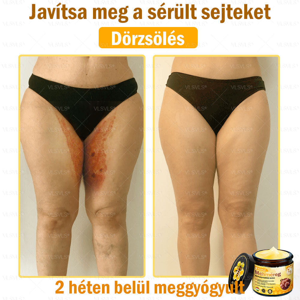 💪💪VLSVLS® Méhméreg Bőrhelyreállító Krém (👨⚕CE jóváhagyott)👍✅