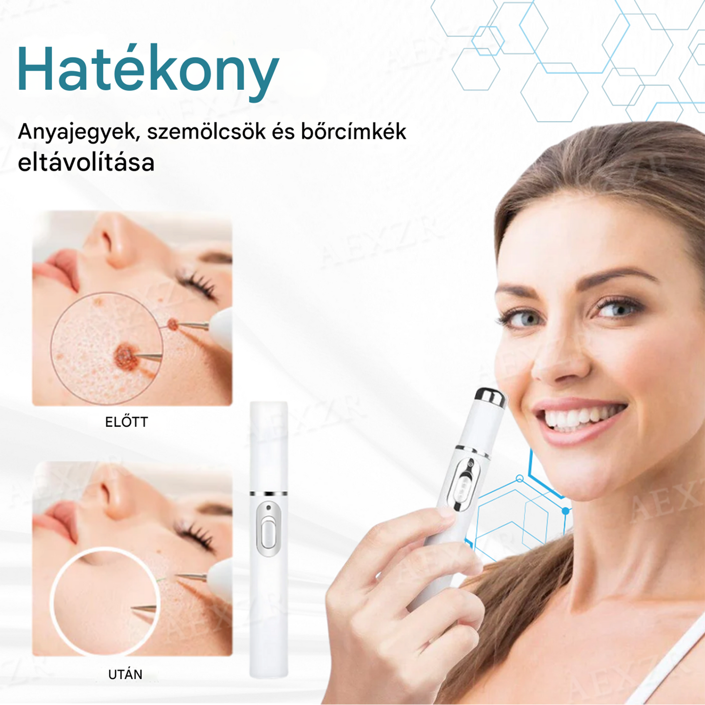 ✅Bikenda® non-invazív anyajegy- és szemölcseltávolító lézertoll