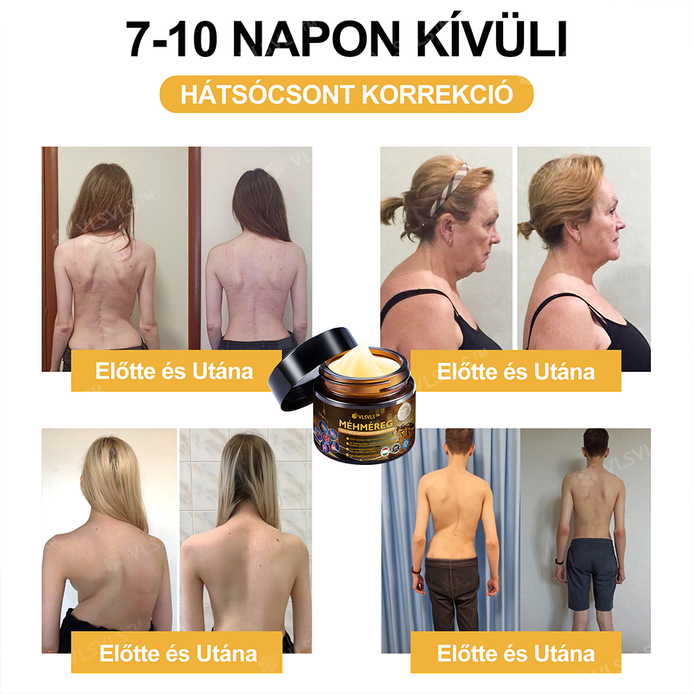 VLSVLS™ Méhméreg Azonnali Ultra Erős Fájdalomcsillapító Krém - (Enyhíti a fájdalmat ízületi gyulladás, izomfájdalom, hátfájás, térdek, hát, vállak, csípők, csuklók, kezek esetén)