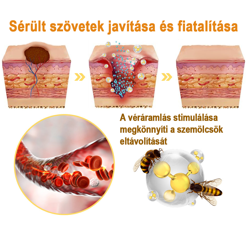 【💗utánvétel (COD)💗】Méhméreg szemölcs és övsömör eltávolító spray (👨⚕AAD Ajánlott) 🐝🐝🔥(🔥Last Day 80% Off)