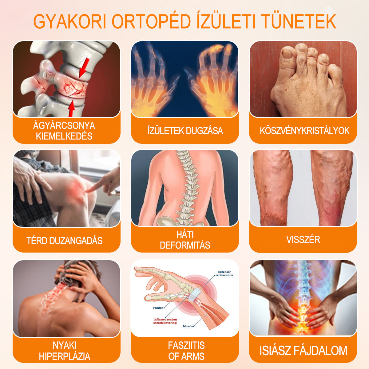 ADNOON® Botulinum Toxin & Méhméreg Fájdalomcsillapító Csontgyógyító Krém👨⚕️A Magyar Ortopéd Társaság (MOT) Által Jóváhagyva