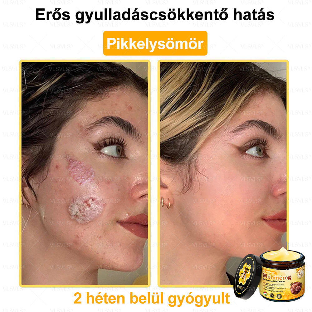 💪💪VLSVLS® Méhméreg Bőrhelyreállító Krém (👨⚕CE jóváhagyott)👍✅