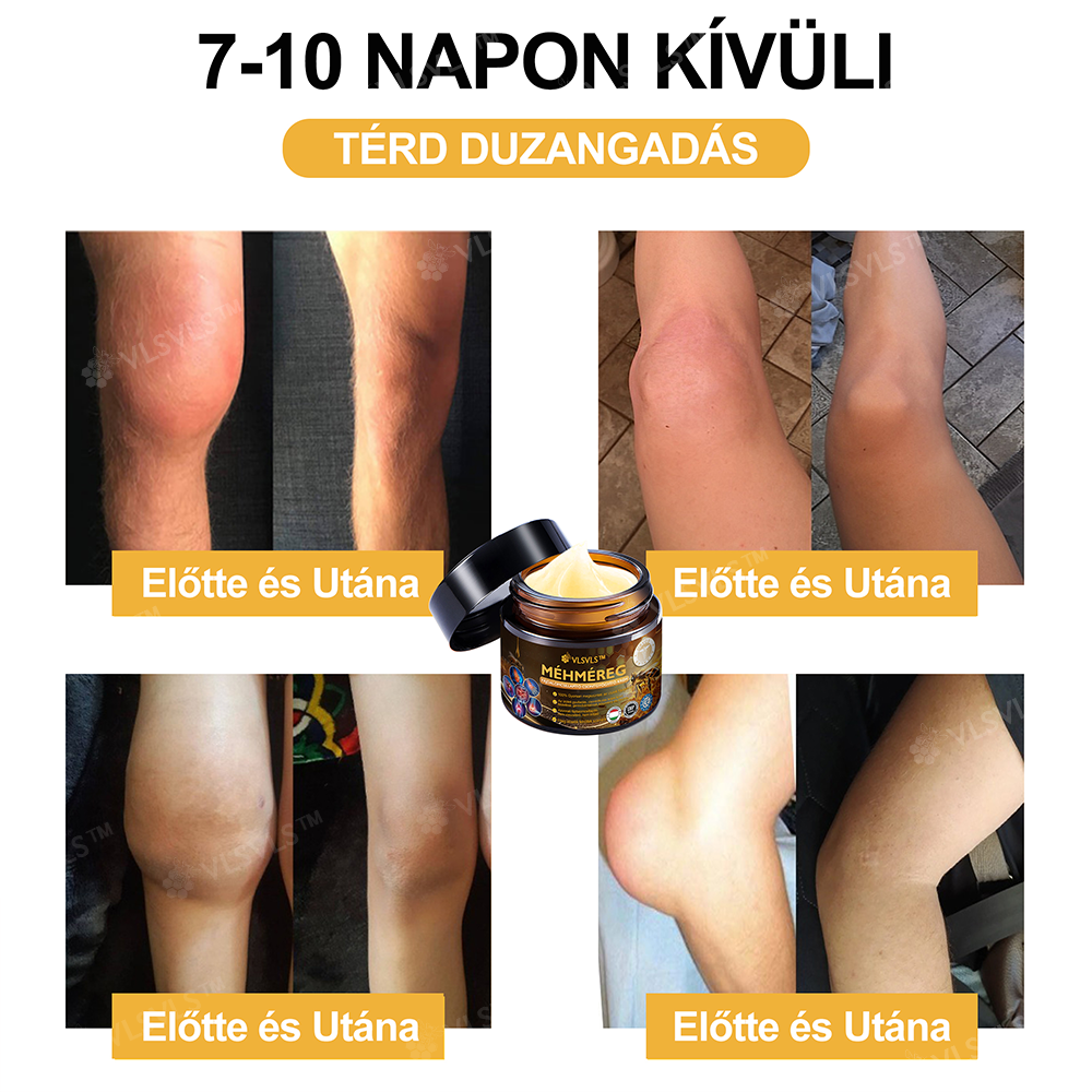VLSVLS™ Méhméreg Azonnali Ultra Erős Fájdalomcsillapító Krém - (Enyhíti a fájdalmat ízületi gyulladás, izomfájdalom, hátfájás, térdek, hát, vállak, csípők, csuklók, kezek esetén)