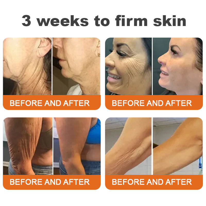 Az USA-ból készült és szállították✨Turonu™ Botox Bee Venom bőrfeszesítő szérumstick (🔥Utolsó NAP 70% KEDVEZMÉNY)💄