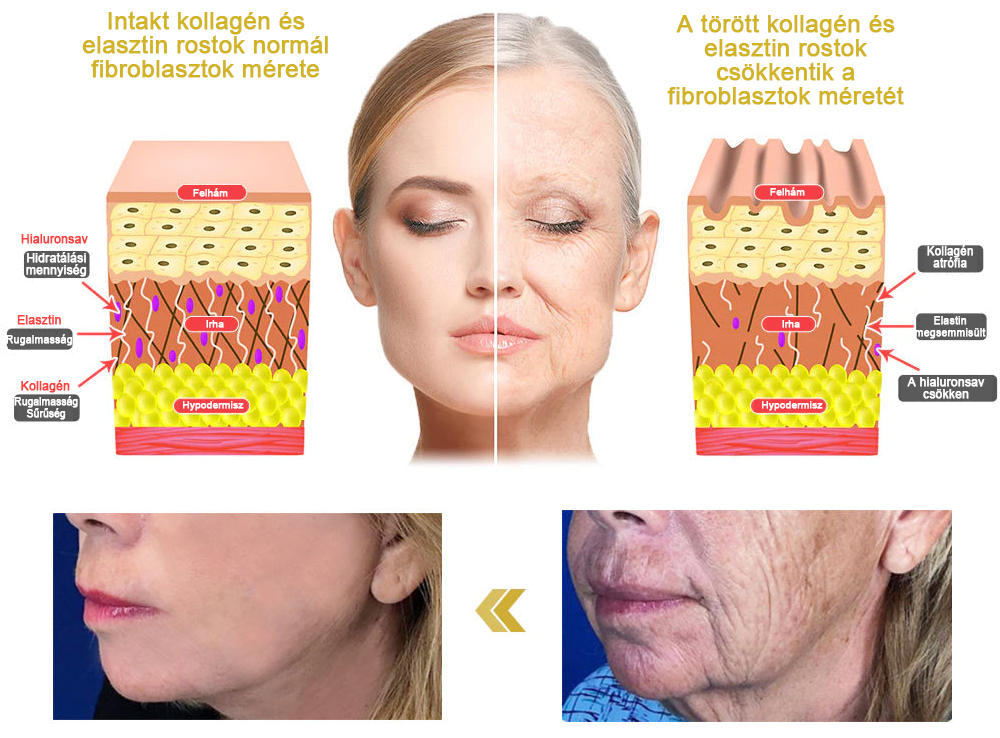 ✨Moondar™ feszesítő krém: Restore Skin Elasticity Last Day Kedvezmény: 75% kedvezmény🛍️