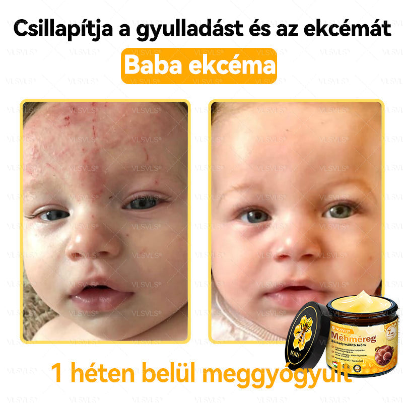 💪💪VLSVLS® Méhméreg Bőrhelyreállító Krém (👨⚕CE jóváhagyott)👍✅