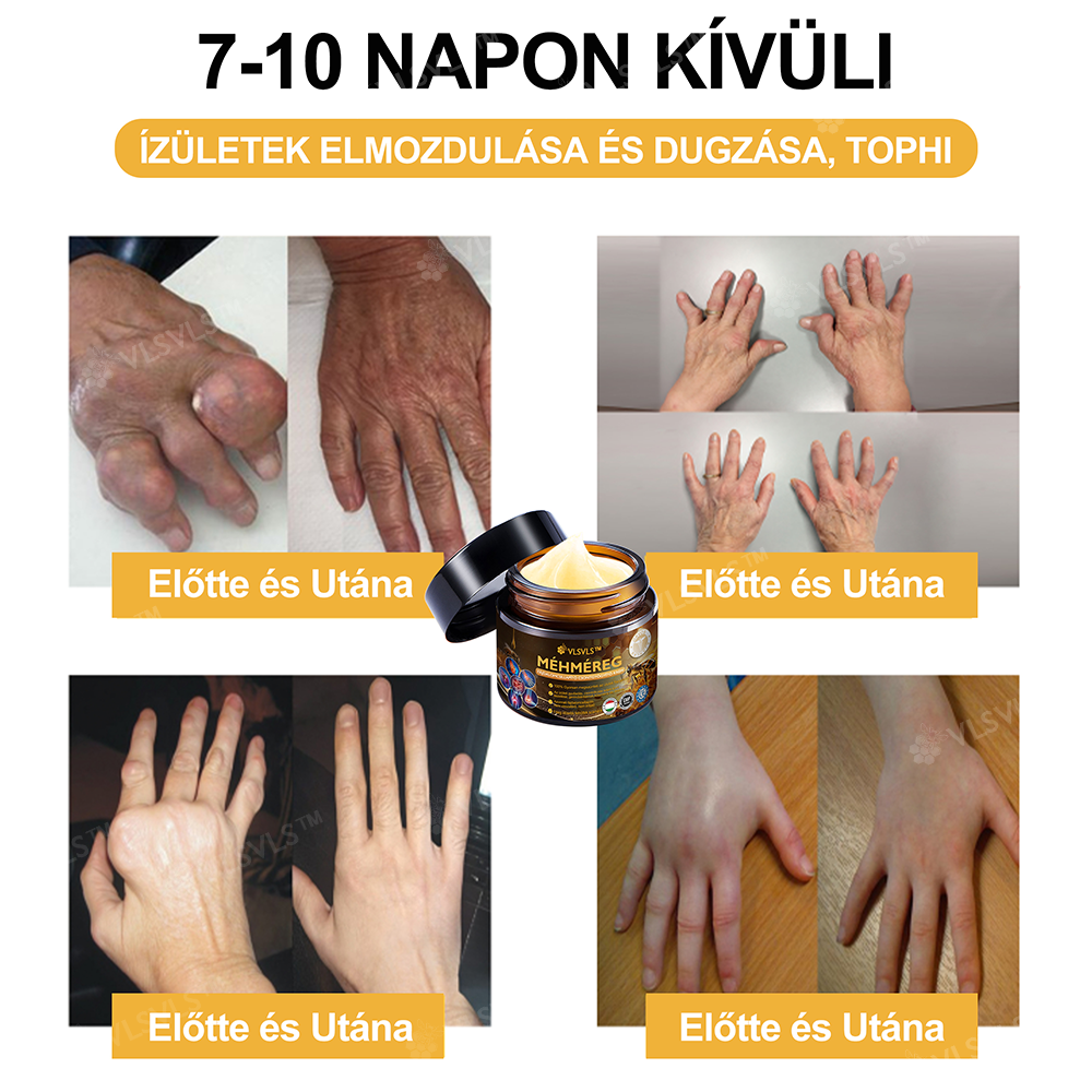 VLSVLS™ Méhméreg Azonnali Ultra Erős Fájdalomcsillapító Krém - (Enyhíti a fájdalmat ízületi gyulladás, izomfájdalom, hátfájás, térdek, hát, vállak, csípők, csuklók, kezek esetén)