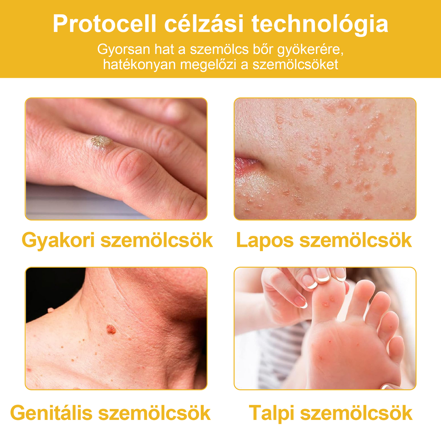 đ”ïžTuronuâą mĂ©hmĂ©reg kezelĆ bĆrkrĂ©m (az MDT ajĂĄnlĂĄsĂĄval)