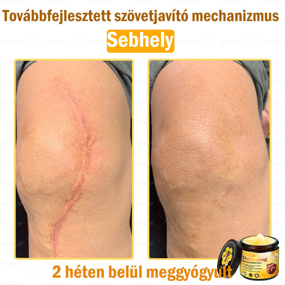 💪💪VLSVLS® Méhméreg Bőrhelyreállító Krém (👨⚕CE jóváhagyott)👍✅