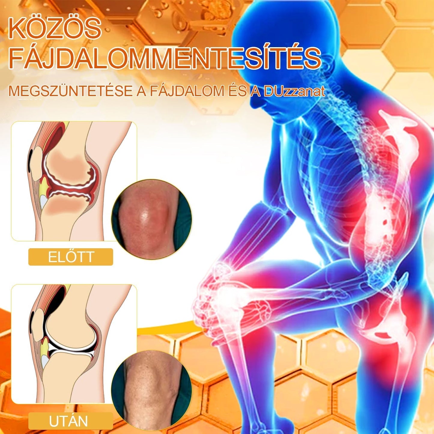 VLSVLS™ Méhméreg Azonnali Ultra Erős Fájdalomcsillapító Krém - (Enyhíti a fájdalmat ízületi gyulladás, izomfájdalom, hátfájás, térdek, hát, vállak, csípők, csuklók, kezek esetén)