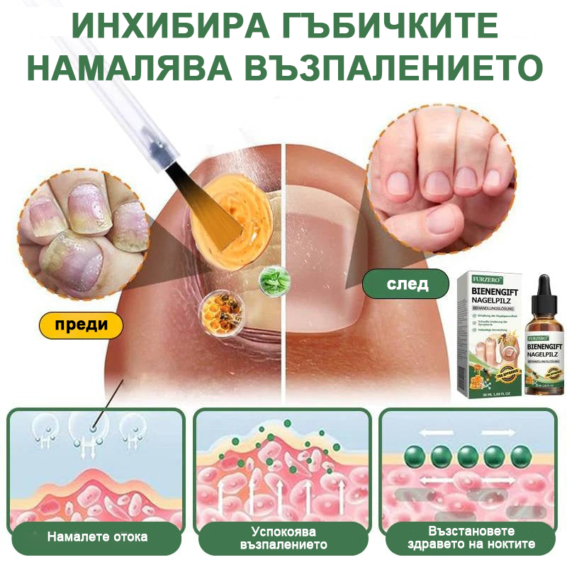 👩‍⚕️Furzero™Nail protection серум за лечение с пчелна отрова