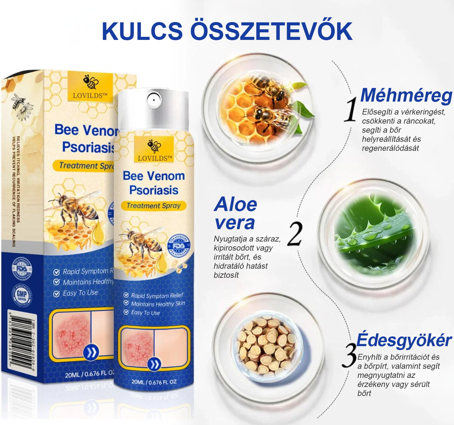 (🔥Utánvéttel🔥60% KEDVEZMÉNY) LOVILDS™ PsoriaHeal Psoriasis Spray (Szállítás világszerte – Ingyenes szállítás) 🌐