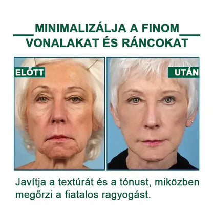 【✨utánvétel (COD)✨】Akció utolsó napja 80% kedvezmény - Fubsta™ Fiatalító és feszesítő bőrszérum🔥