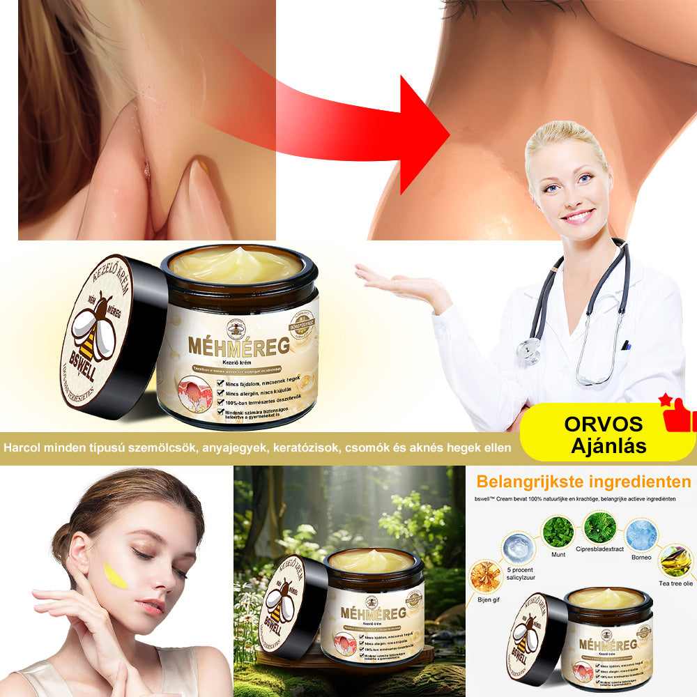 BSWELL® Méhméreg Kezelés Krém👨‍⚕️（AAD ajánlott） (🔥utolsó nap promóció 80% ki）