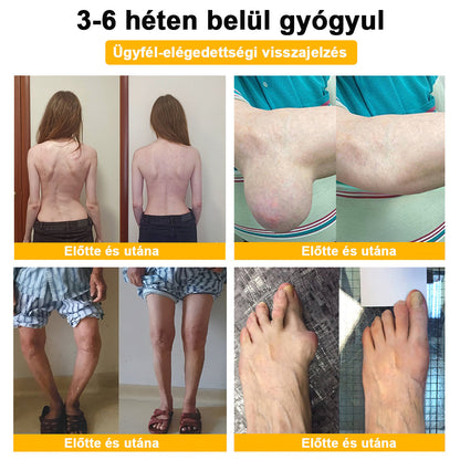 ADNOON® Botulinum Toxin & Méhméreg Fájdalomcsillapító Csontgyógyító Krém👨‍⚕️A Magyar Ortopéd Társaság (MOT) Által Jóváhagyva
