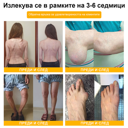 ArthroFree™ Крем за облекчаване на болката в костите с пчелна отрова (Специално за възрастни хора, препоръчван от Американската академия по ортопедична хирургия - AAOS)