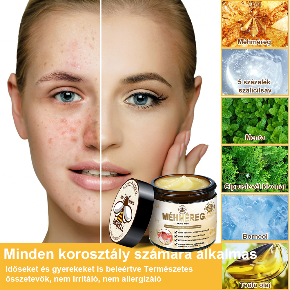 BSWELL® Méhméreg Kezelés Krém👨‍⚕️（AAD ajánlott） (🔥utolsó nap promóció 80% ki）