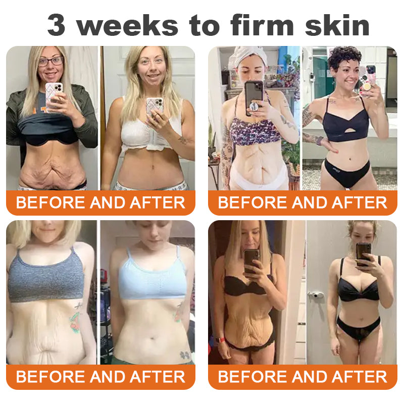 Az USA-ból készült és szállították✨Turonu™ Botox Bee Venom bőrfeszesítő szérumstick (🔥Utolsó NAP 70% KEDVEZMÉNY)💄