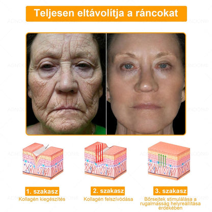 ADNOON® 🌼 7 napos erőteljes bőregészség-javító krém – ajánlja a Magyar Dermatológiai Társulat (MDT) 👨‍⚕️