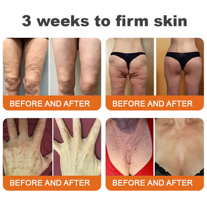 Az USA-ból készült és szállították✨Turonu™ Botox Bee Venom bőrfeszesítő szérumstick (🔥Utolsó NAP 70% KEDVEZMÉNY)💄