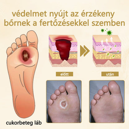 Cvreoz® méhméreg gyógyító spray a sebek gyógyulására és regenerálására a kezeken és a lábakon🌿🌿🌿🌿🌿🌿