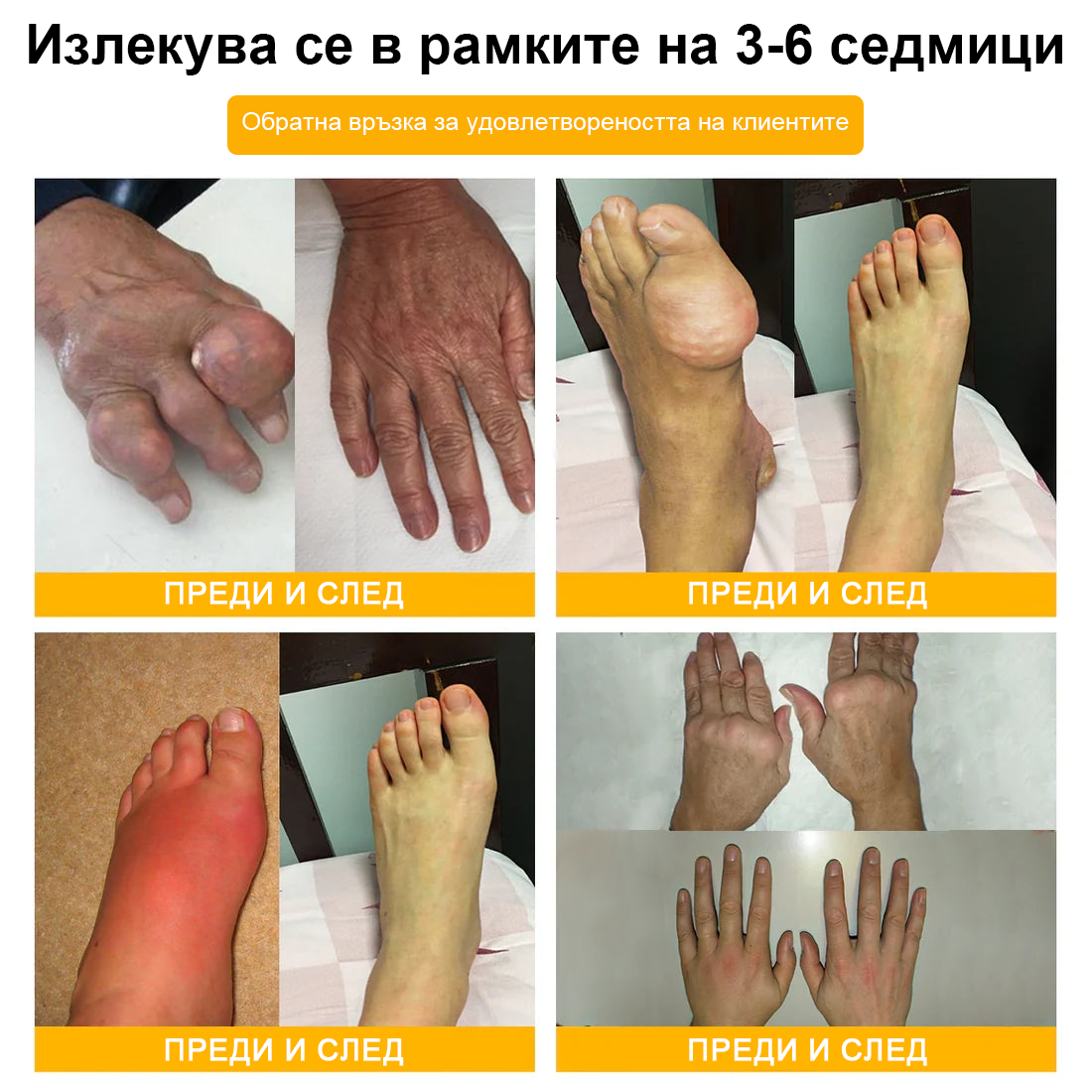 ArthroFree™ Крем за облекчаване на болката в костите с пчелна отрова (Специално за възрастни хора, препоръчван от Американската академия по ортопедична хирургия - AAOS)