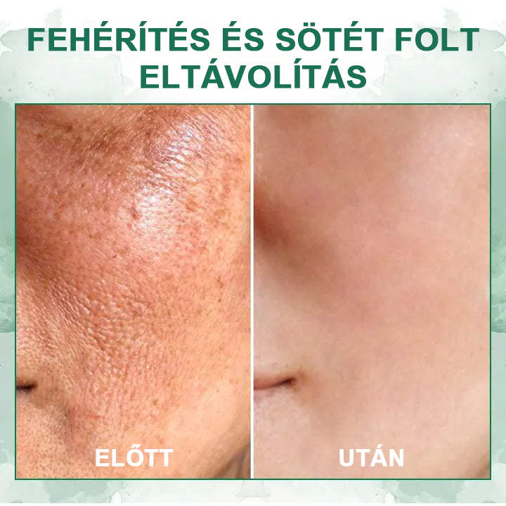 【✨utánvétel (COD)✨】Akció utolsó napja 80% kedvezmény - Fubsta™ Fiatalító és feszesítő bőrszérum🔥