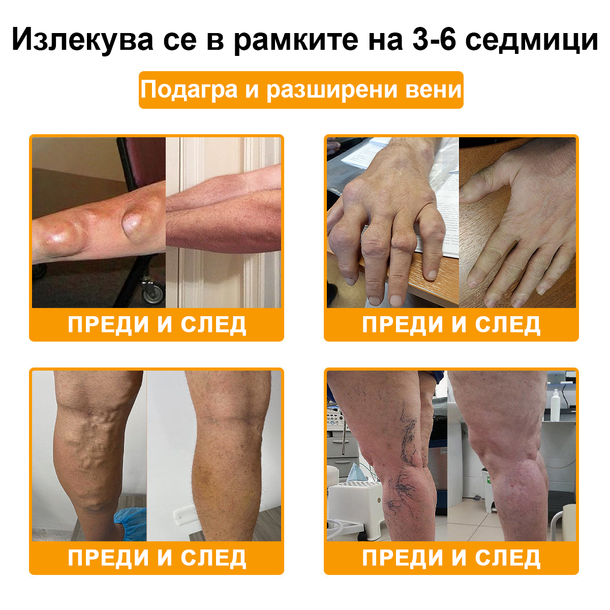 ArthroFree™ Крем за облекчаване на болката в костите с пчелна отрова (Специално за възрастни хора, препоръчван от Американската академия по ортопедична хирургия - AAOS)