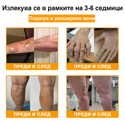 ArthroFree™ Крем за облекчаване на болката в костите с пчелна отрова (Специално за възрастни хора, препоръчван от Американската академия по ортопедична хирургия - AAOS)