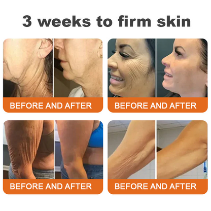 Az USA-ból készült és szállították✨Turonu™ Botox Bee Venom bőrfeszesítő szérumstick (🔥Utolsó NAP 70% KEDVEZMÉNY)💄