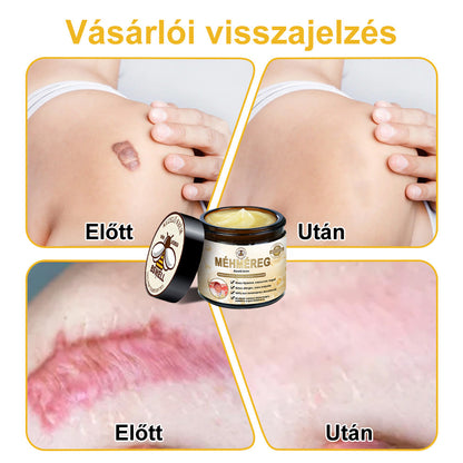 BSWELL® Méhméreg Kezelés Krém👨‍⚕️（AAD ajánlott） (🔥utolsó nap promóció 80% ki）