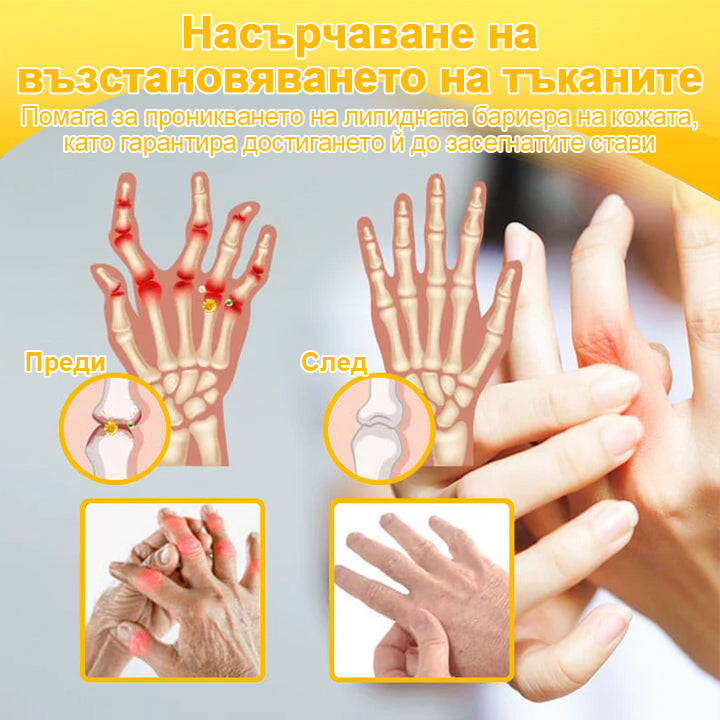 ArthroFree™ Крем за облекчаване на болката в костите с пчелна отрова (Специално за възрастни хора, препоръчван от Американската академия по ортопедична хирургия - AAOS)