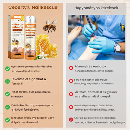 méhméreg spray – 2 hét alatt orvosolja a körömgombát! 🚀