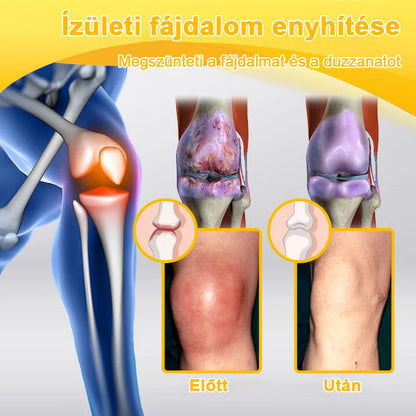 ADNOON® Botulinum Toxin & Méhméreg Fájdalomcsillapító Csontgyógyító Krém👨‍⚕️A Magyar Ortopéd Társaság (MOT) Által Jóváhagyva