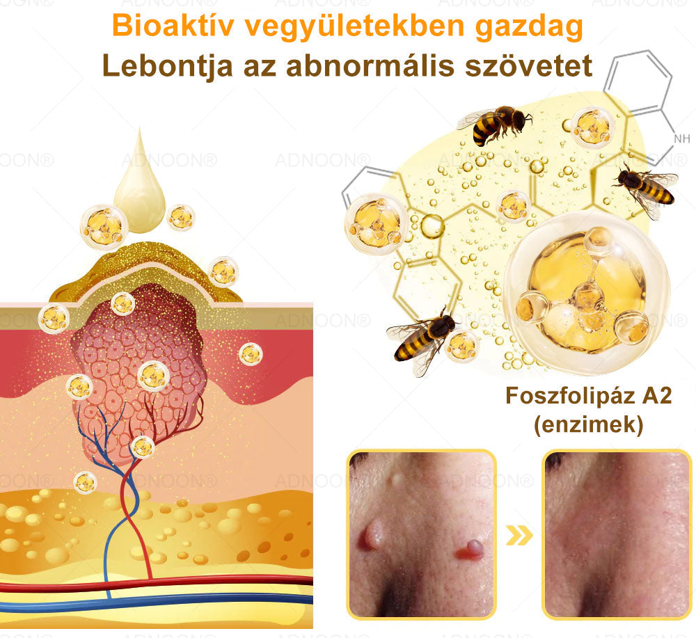 ADNOON® 🌼 7 napos erőteljes bőregészség-javító krém – ajánlja a Magyar Dermatológiai Társulat (MDT) 👨‍⚕️