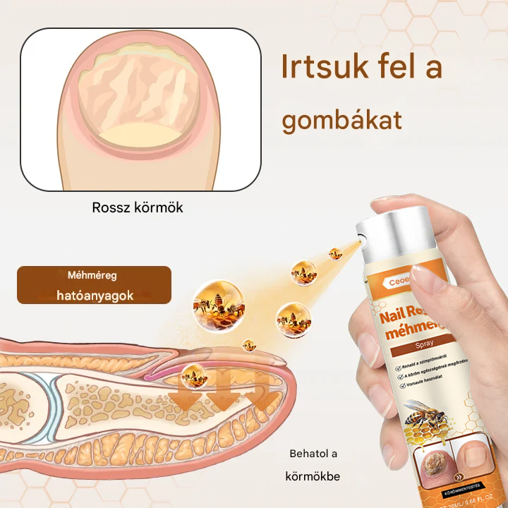 méhméreg spray – 2 hét alatt orvosolja a körömgombát! 🚀
