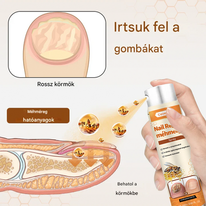 méhméreg spray – 2 hét alatt orvosolja a körömgombát! 🚀