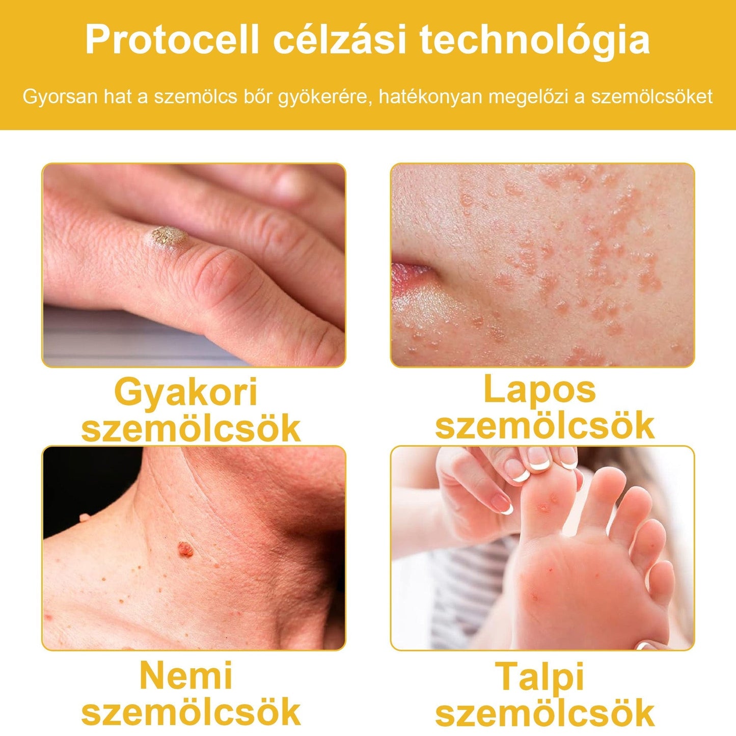 BSWELL® Méhméreg Kezelés Krém👨‍⚕️（AAD ajánlott） (🔥utolsó nap promóció 80% ki）