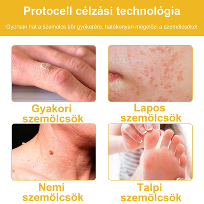 BSWELL® Méhméreg Kezelés Krém👨‍⚕️（AAD ajánlott） (🔥utolsó nap promóció 80% ki）