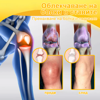 ArthroFree™ Крем за облекчаване на болката в костите с пчелна отрова (Специално за възрастни хора, препоръчван от Американската академия по ортопедична хирургия - AAOS)