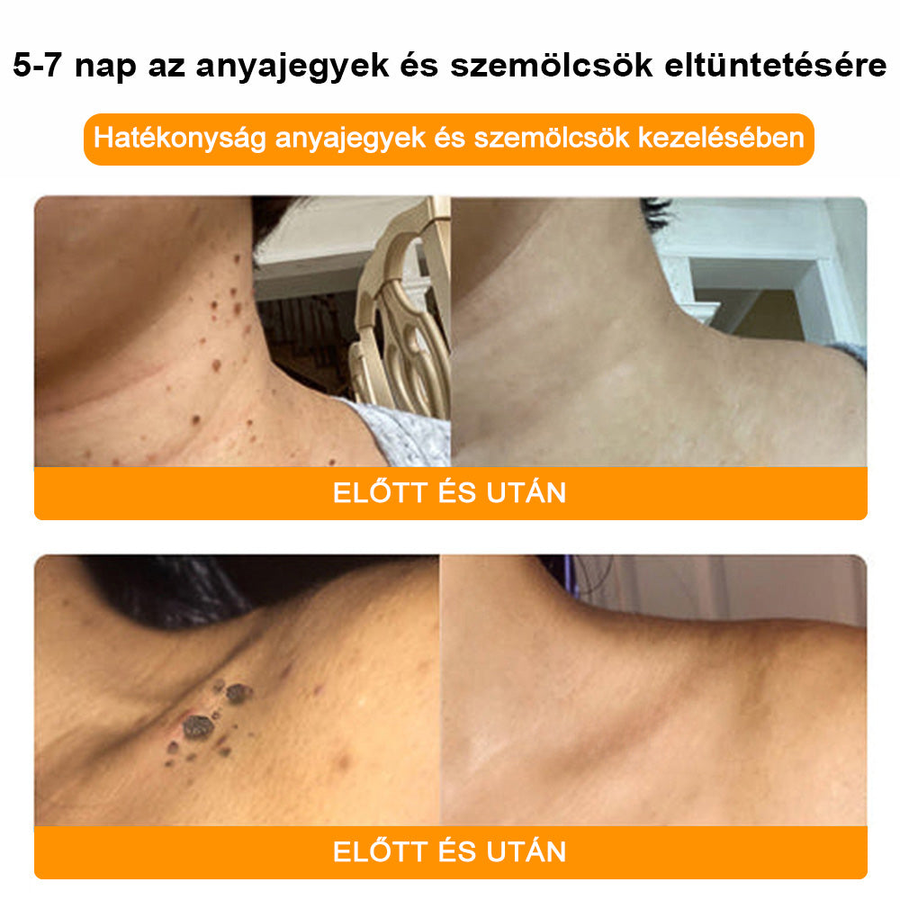 BSWELL® Méhméreg Kezelés Krém👨‍⚕️（AAD ajánlott） (🔥utolsó nap promóció 80% ki）