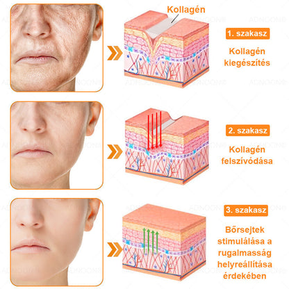 ADNOON® 🌼 7 napos erőteljes bőregészség-javító krém – ajánlja a Magyar Dermatológiai Társulat (MDT) 👨‍⚕️