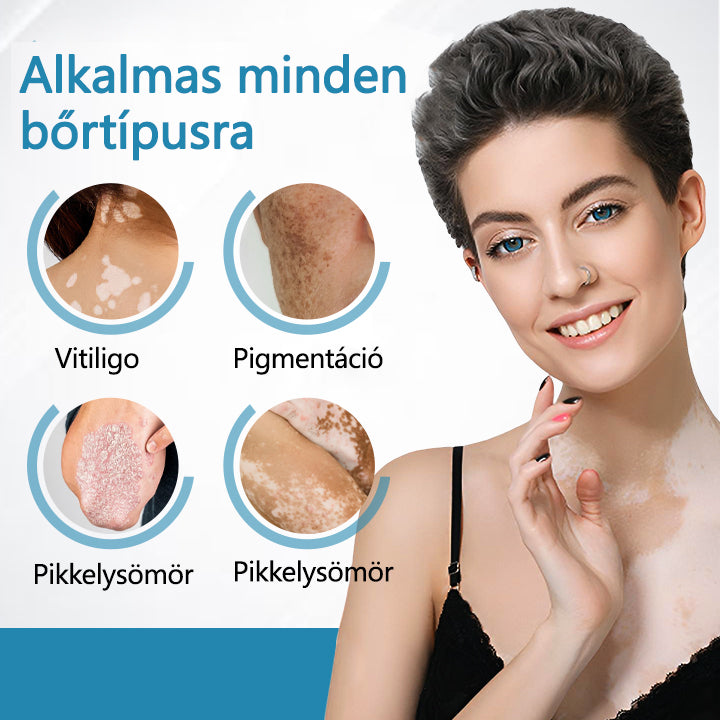 Bikenda® DermaBeam Vitiligo Therapy Device💙