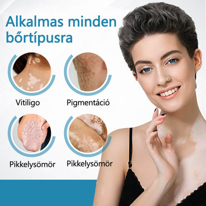 Bikenda® DermaBeam Vitiligo Therapy Device💙