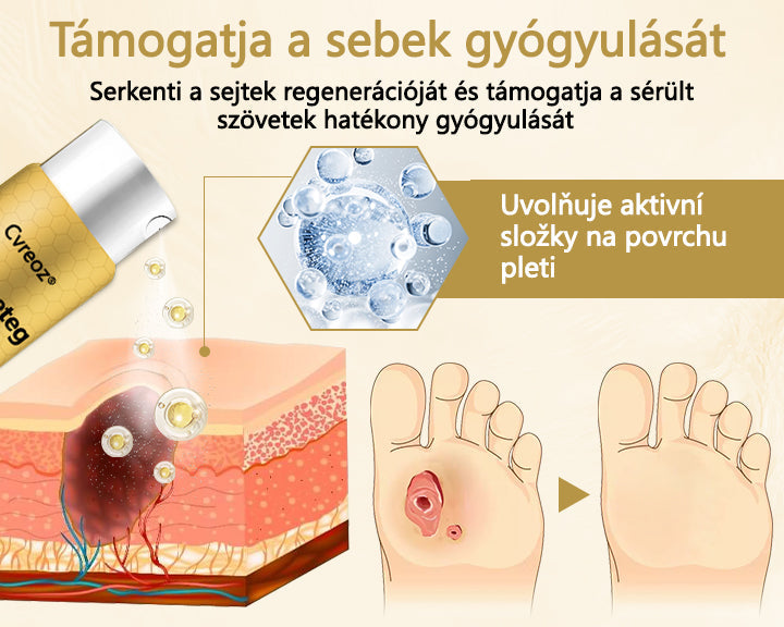 Cvreoz® méhméreg gyógyító spray a sebek gyógyulására és regenerálására a kezeken és a lábakon🌿🌿🌿🌿🌿🌿