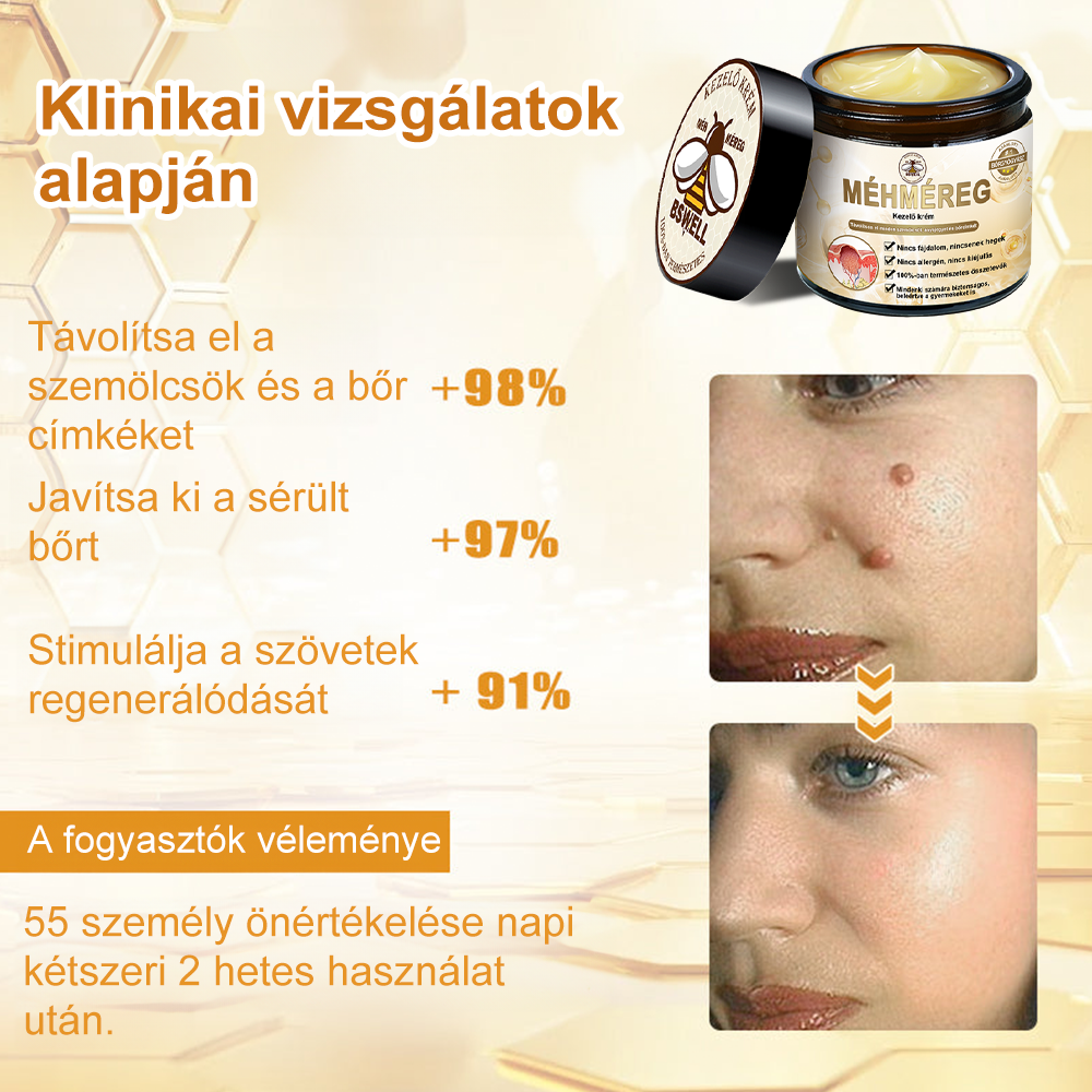BSWELL® Méhméreg Kezelés Krém👨‍⚕️（AAD ajánlott） (🔥utolsó nap promóció 80% ki）