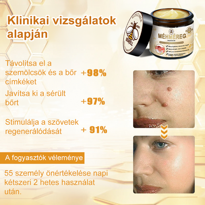 BSWELL® Méhméreg Kezelés Krém👨‍⚕️（AAD ajánlott） (🔥utolsó nap promóció 80% ki）