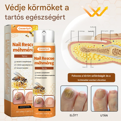 méhméreg spray – 2 hét alatt orvosolja a körömgombát! 🚀