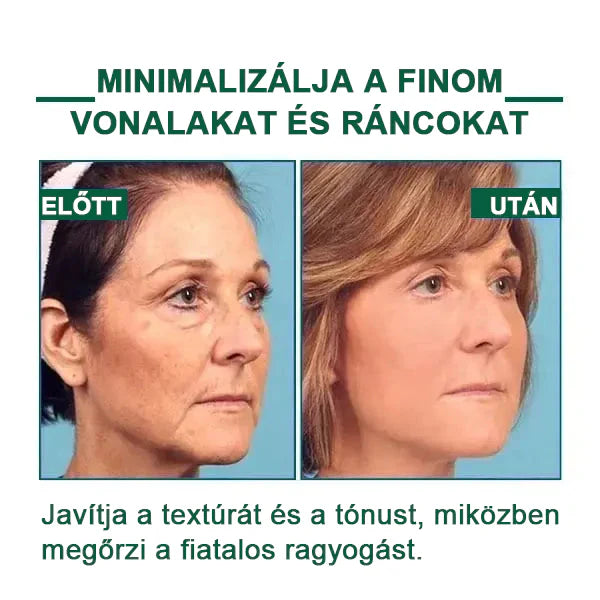 【✨utánvétel (COD)✨】Akció utolsó napja 80% kedvezmény - Fubsta™ Fiatalító és feszesítő bőrszérum🔥
